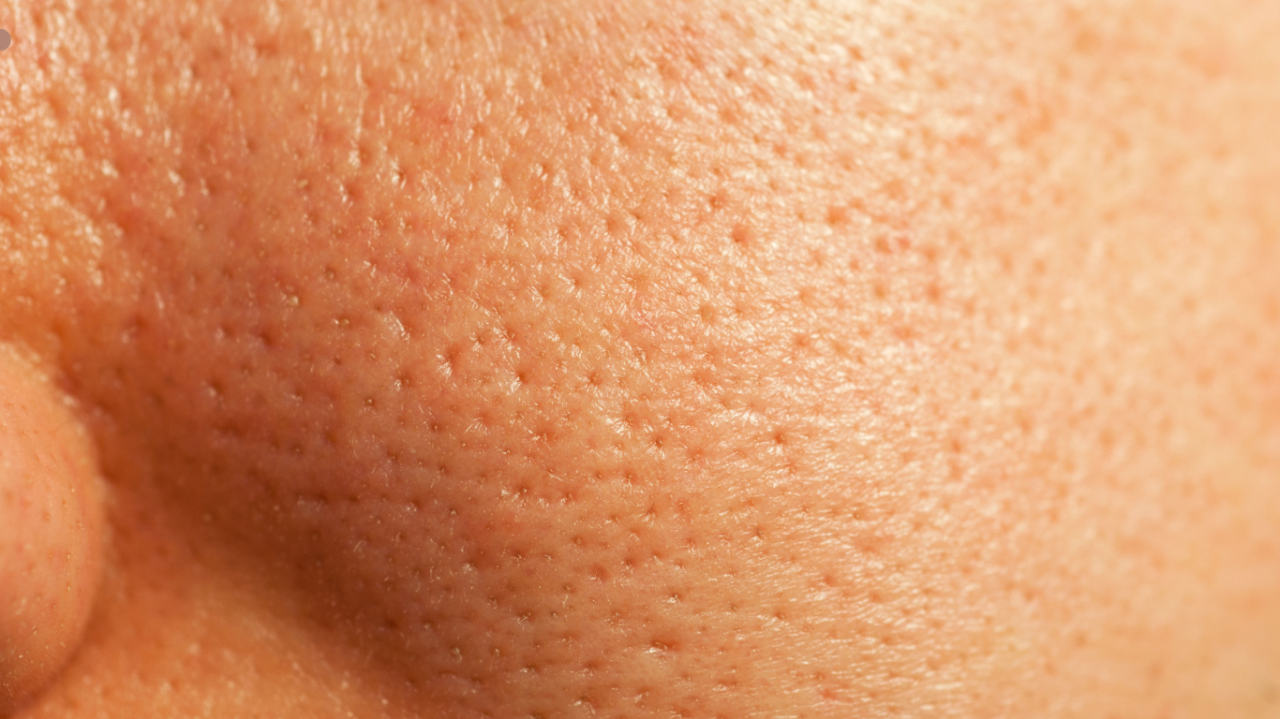 毛穴 でお悩みの方へ